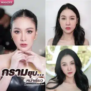 รีวิวโบท็อกซ์ Wandee Clinic