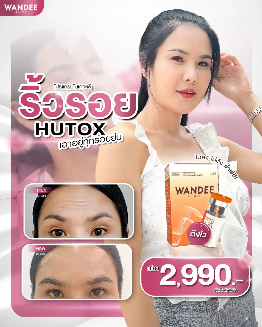 ราคาโบท็อกซ์ ที่ Wandee Clinic