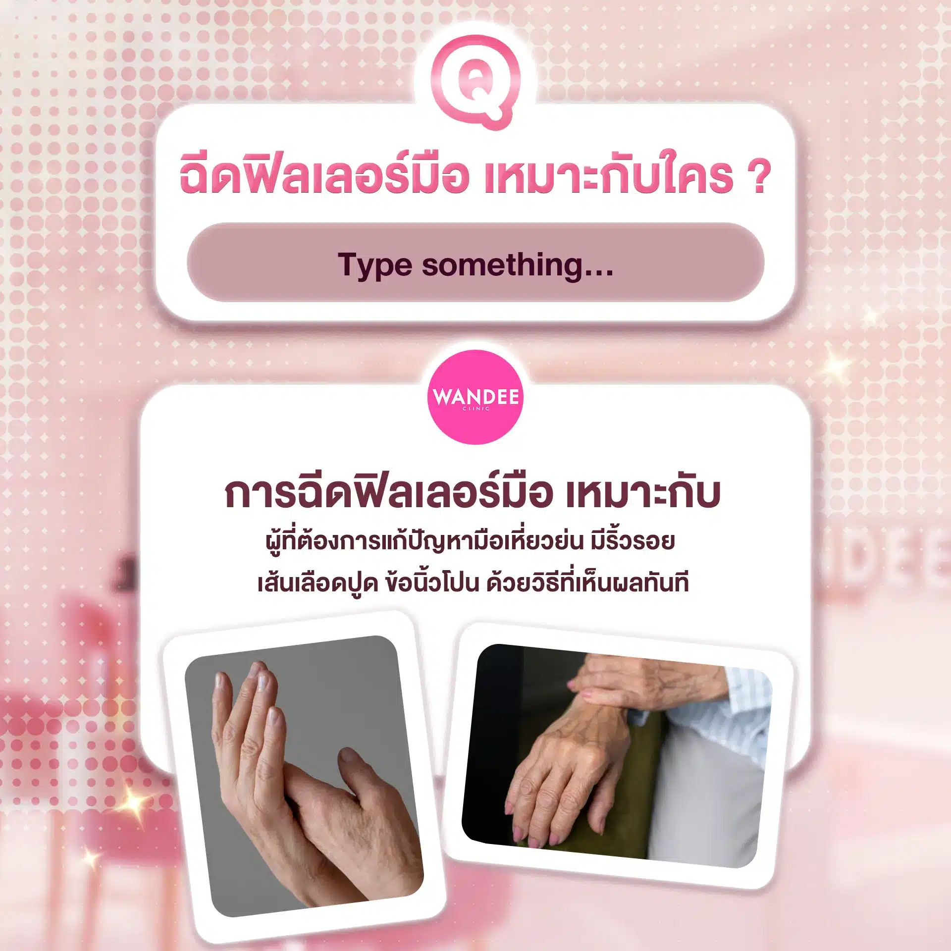 ฉีดฟิลเลอร์มือ โคราช แก้มือเหี่ยว อันตรายไหม ต้องฉีดบ่อยแค่ไหน ?