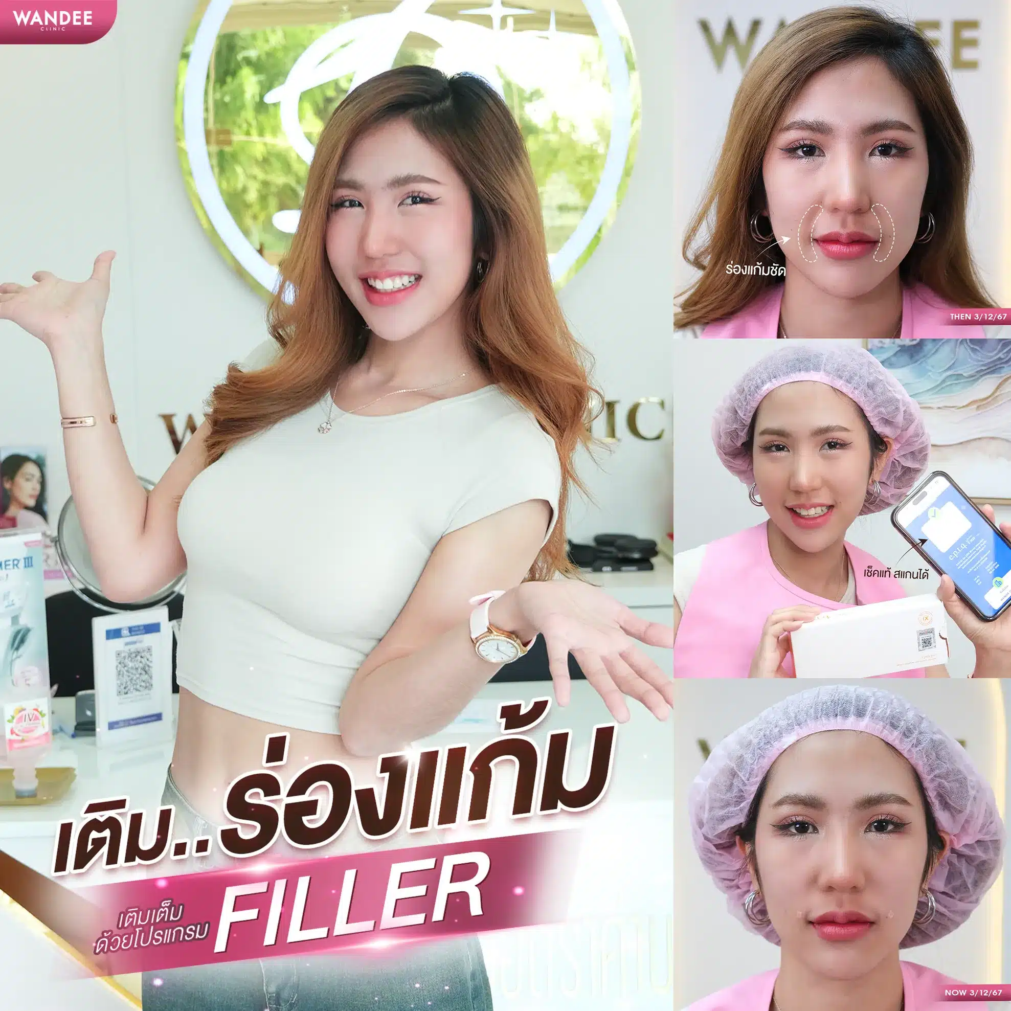 ทำไมต้อง ฉีดฟิลเลอร์ร่องแก้ม โคราช ที่ วันดีคลินิก ?