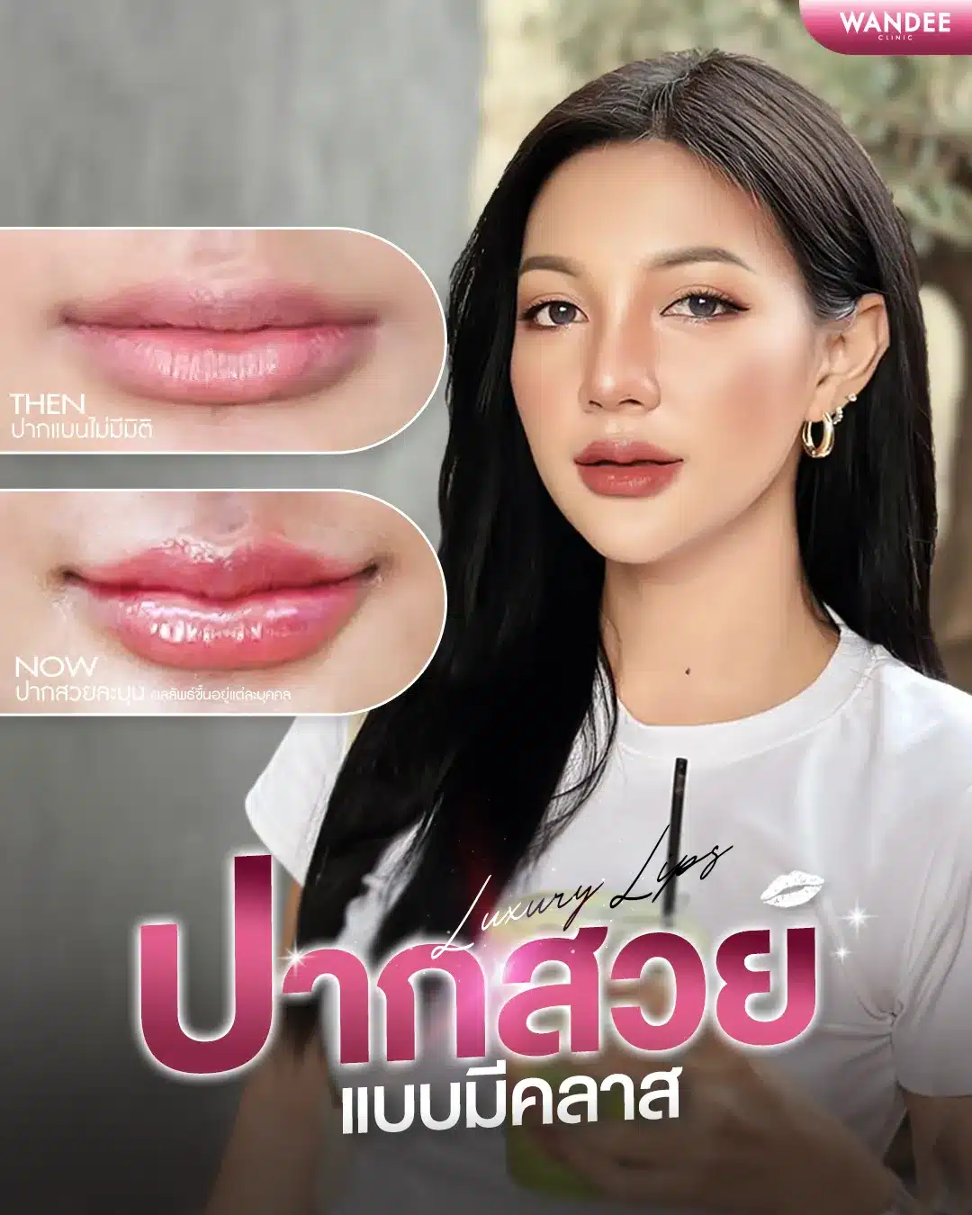 ปรับรูปปากให้อวบอิ่มด้วย ฟิลเลอร์ปาก โคราช ให้สวยละมุน ไม่โป๊ะ