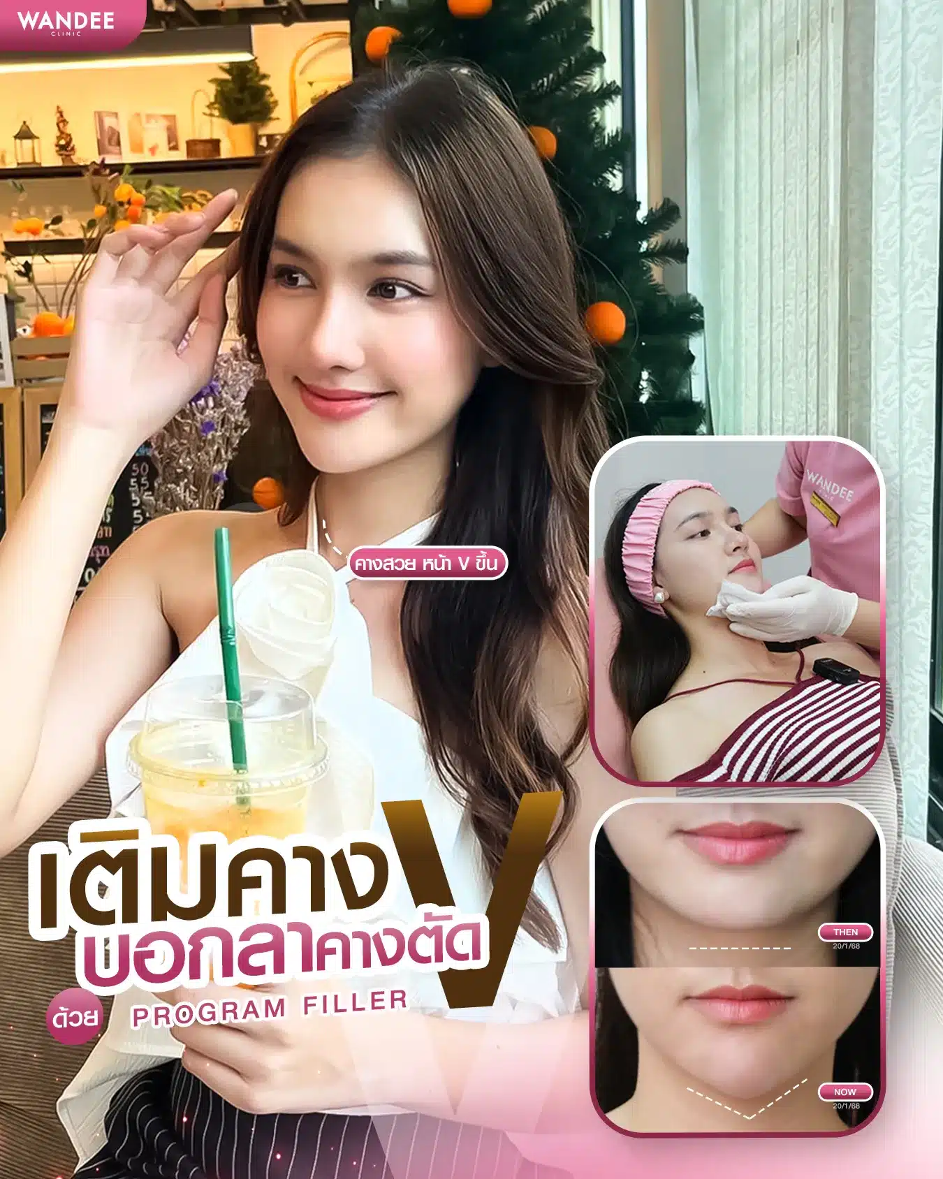 รีวิวฟิลเลอร์คาง Wandee Clinic