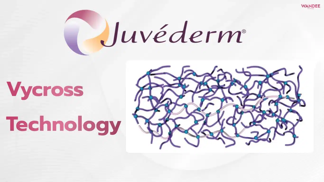Vycross Technology