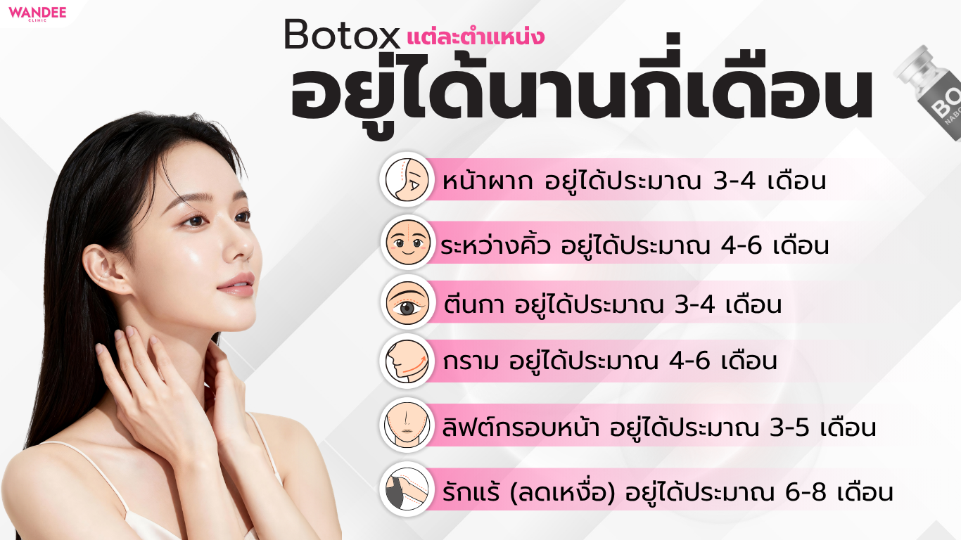 โบท็อกซ์ อยู่ได้นานกี่เดือน