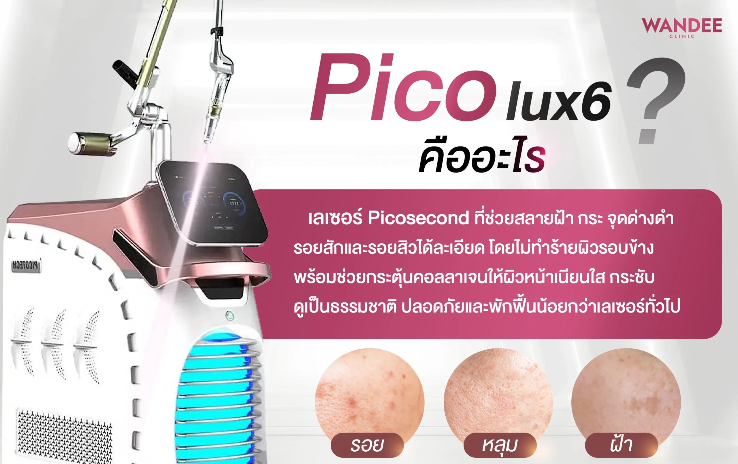 Pico Laser คืออะไร หลักการทำงานของเทคโนโลยี Pico