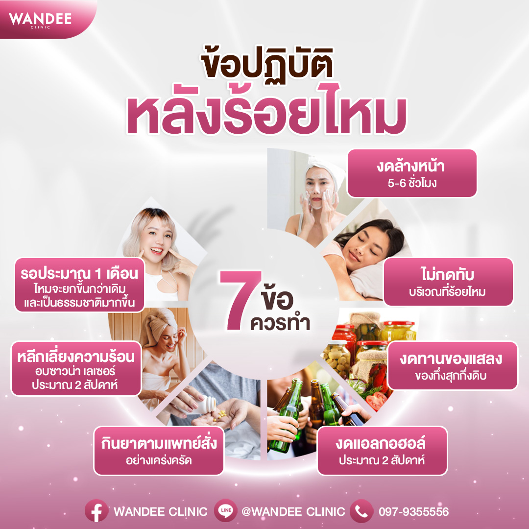 การดูแลตัวเองหลังร้อยไหม
